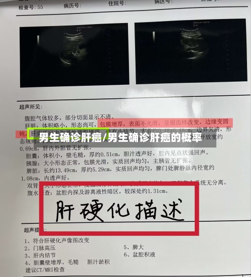 男生确诊肝癌/男生确诊肝癌的概率-第2张图片