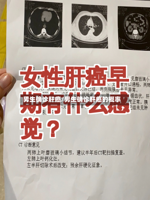 男生确诊肝癌/男生确诊肝癌的概率