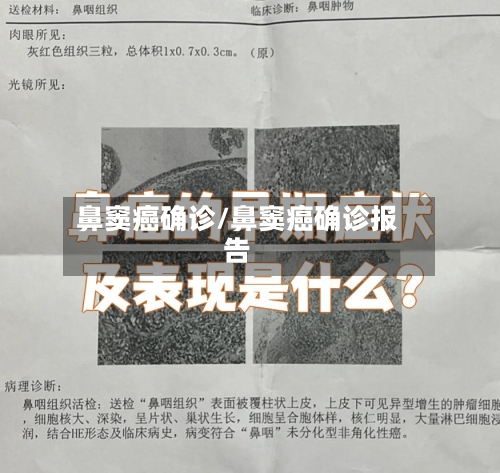 鼻窦癌确诊/鼻窦癌确诊报告-第2张图片