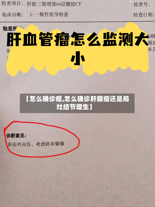 【怎么确诊瘤,怎么确诊肝腺瘤还是局灶结节增生】-第3张图片
