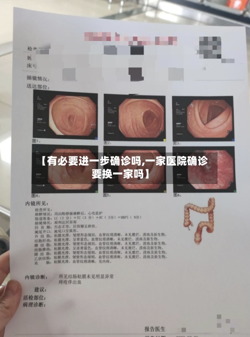 【有必要进一步确诊吗,一家医院确诊要换一家吗】-第2张图片