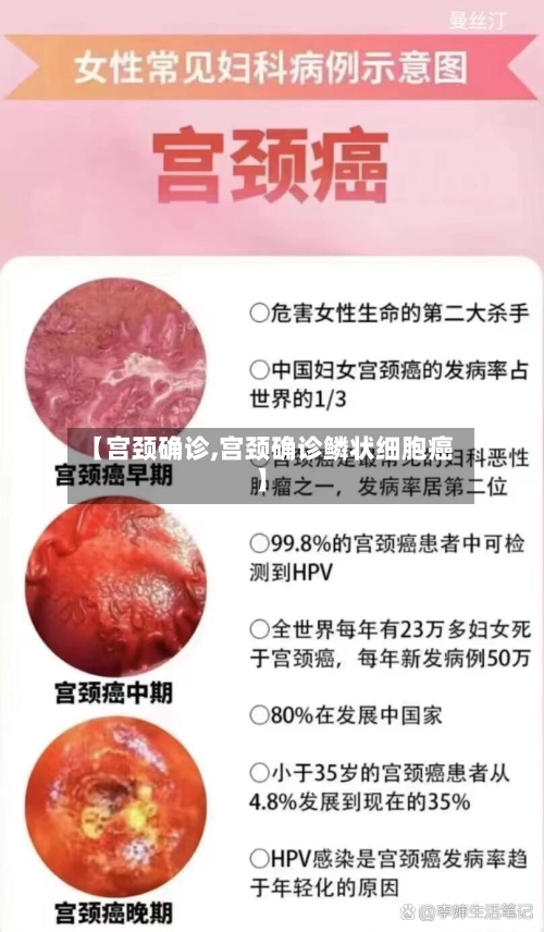 【宫颈确诊,宫颈确诊鳞状细胞癌】-第2张图片