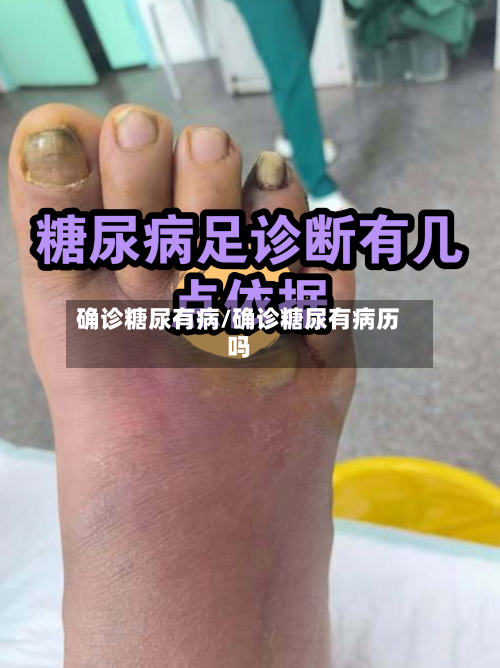 确诊糖尿有病/确诊糖尿有病历吗-第2张图片