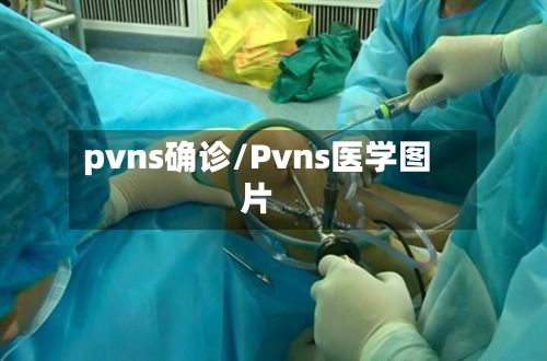 pvns确诊/Pvns医学图片-第3张图片