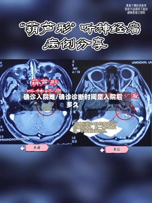 确诊入院难/确诊诊断时间是入院后多久-第3张图片