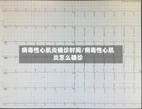 病毒性心肌炎确诊时间/病毒性心肌炎怎么确诊-第2张图片