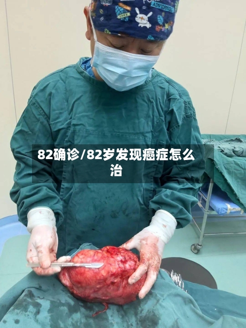 82确诊/82岁发现癌症怎么治-第2张图片