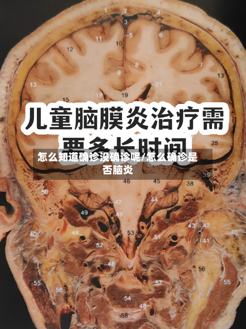 怎么知道确诊没确诊呢/怎么确诊是否脑炎