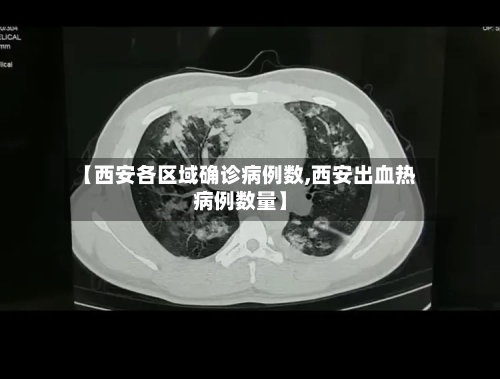 【西安各区域确诊病例数,西安出血热病例数量】