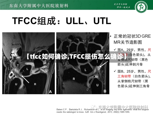 【tfcc如何确诊,TFCC损伤怎么确诊】-第2张图片