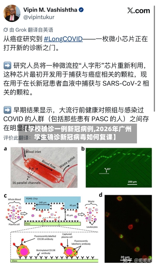 【学校确诊一例新冠病例,2026年广州学生确诊新冠病毒如何复课】
