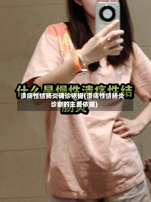 溃疡性结肠炎确诊依据(溃疡性结肠炎诊断的主要依据)-第2张图片