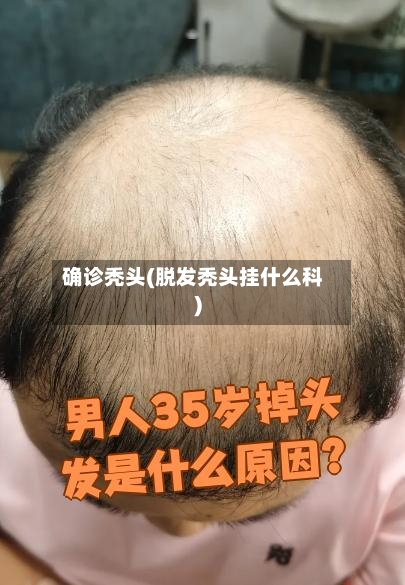 确诊秃头(脱发秃头挂什么科)