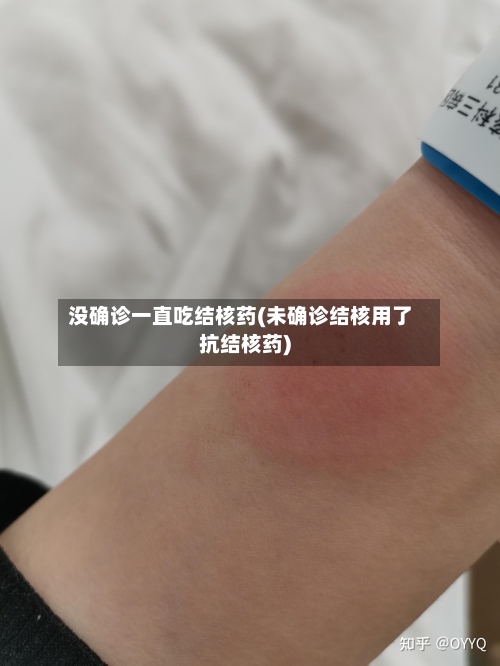 没确诊一直吃结核药(未确诊结核用了抗结核药)-第2张图片