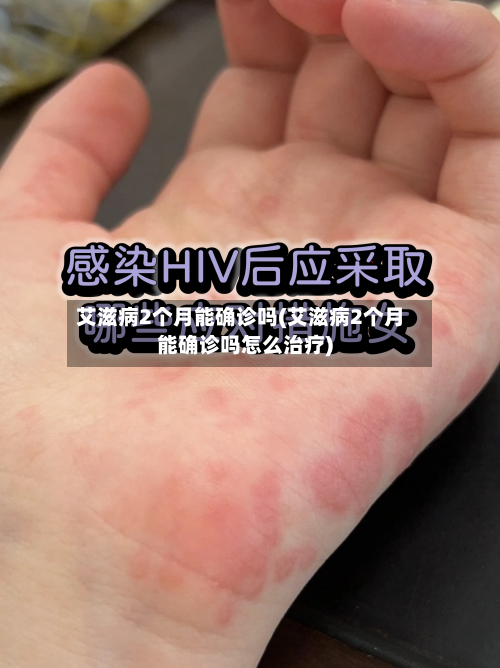 艾滋病2个月能确诊吗(艾滋病2个月能确诊吗怎么治疗)