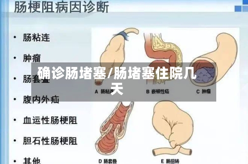 确诊肠堵塞/肠堵塞住院几天