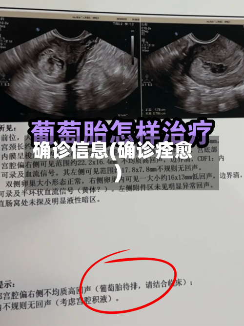确诊信息(确诊痊愈)