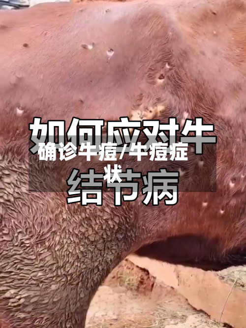 确诊牛痘/牛痘症状