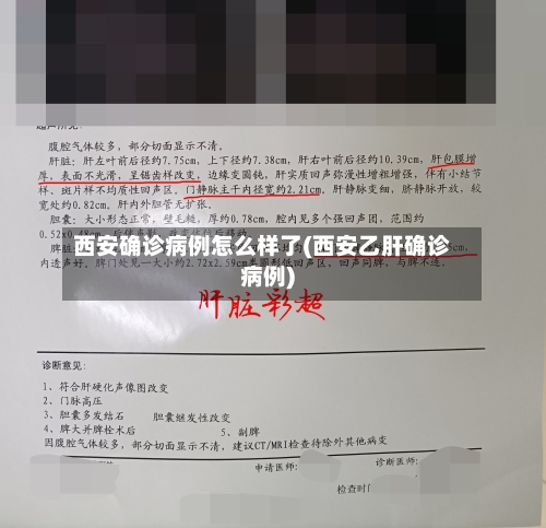 西安确诊病例怎么样了(西安乙肝确诊病例)