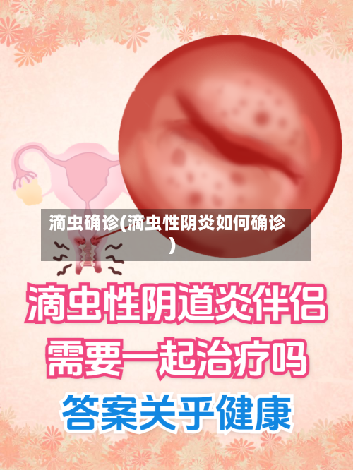 滴虫确诊(滴虫性阴炎如何确诊)