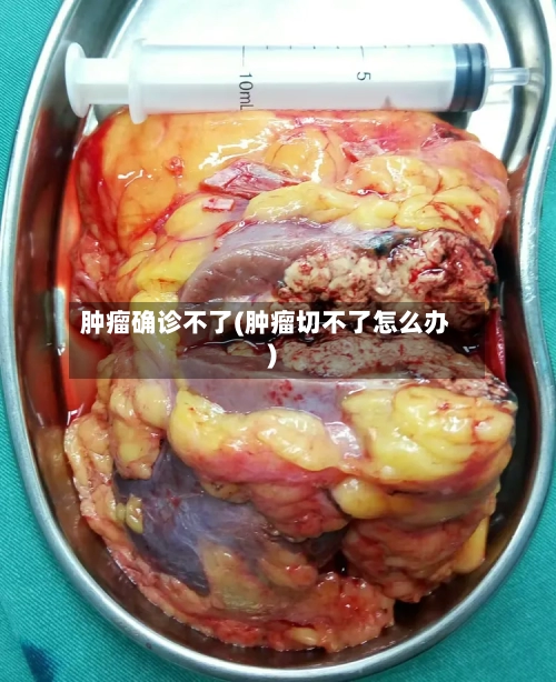 肿瘤确诊不了(肿瘤切不了怎么办)