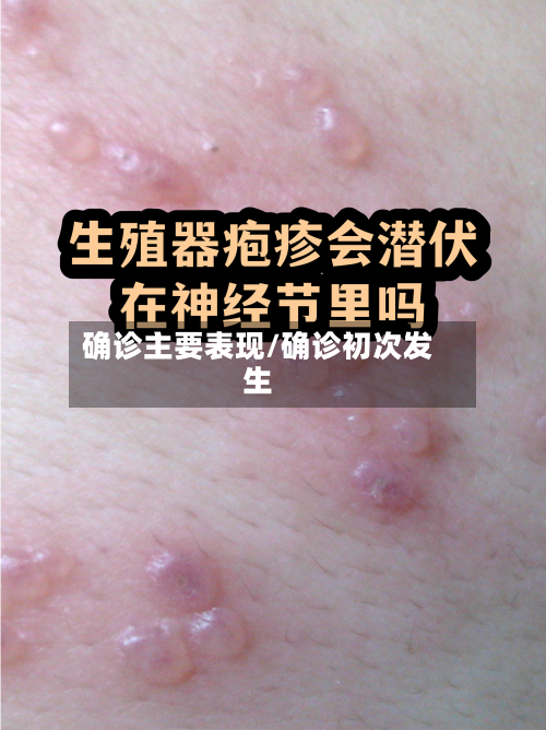 确诊主要表现/确诊初次发生-第3张图片