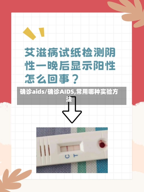 确诊aids/确诊AIDS,常用哪种实验方法-第2张图片