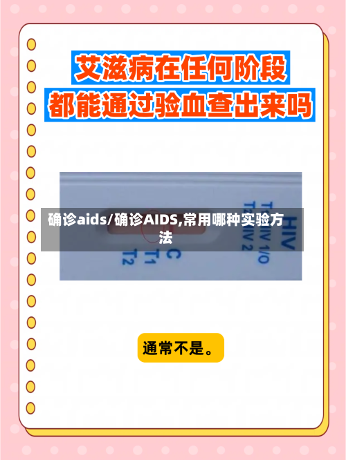 确诊aids/确诊AIDS,常用哪种实验方法-第3张图片
