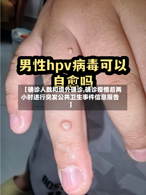 【确诊人数和境外确诊,确诊疫情后两小时进行突发公共卫生事件信息报告】-第3张图片