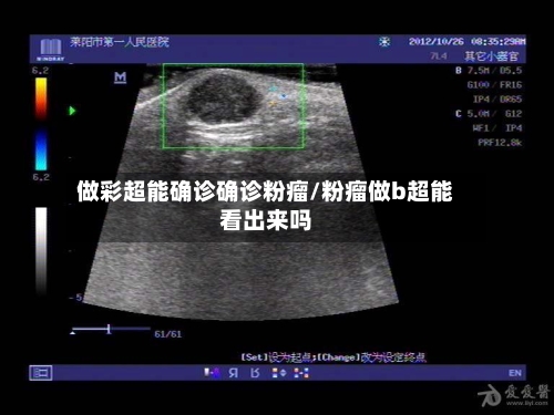 做彩超能确诊确诊粉瘤/粉瘤做b超能看出来吗-第2张图片