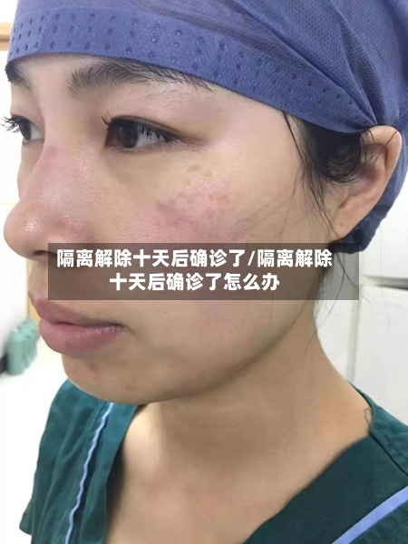 隔离解除十天后确诊了/隔离解除十天后确诊了怎么办-第2张图片