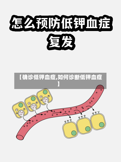 【确诊低钾血症,如何诊断低钾血症】