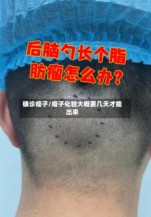 确诊瘤子/瘤子化验大概要几天才能出来-第2张图片