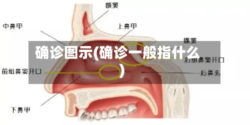 确诊图示(确诊一般指什么)