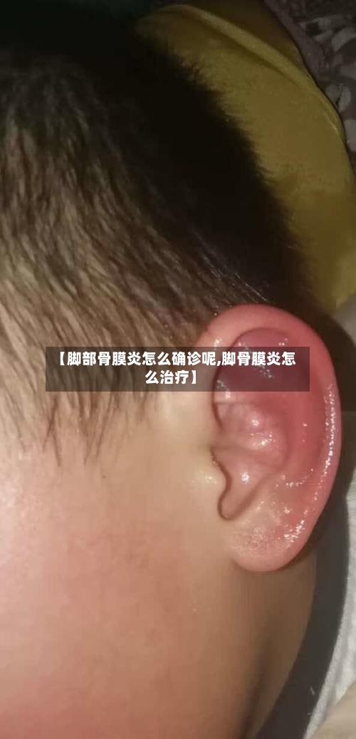 【脚部骨膜炎怎么确诊呢,脚骨膜炎怎么治疗】