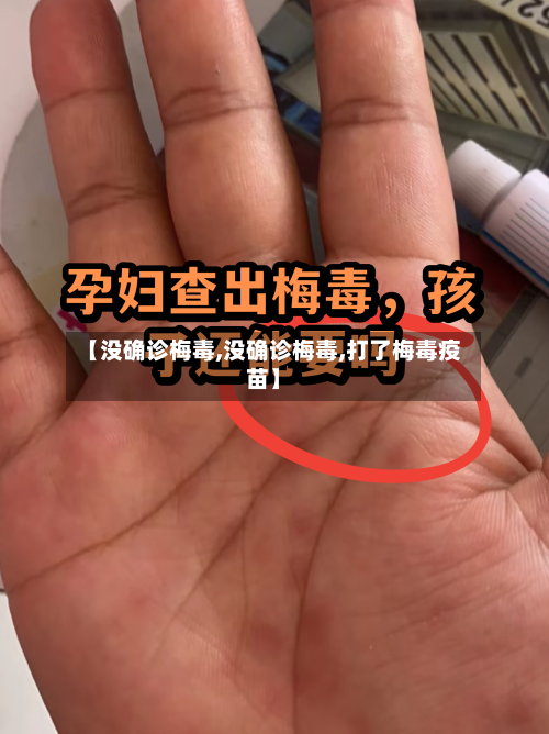 【没确诊梅毒,没确诊梅毒,打了梅毒疫苗】
